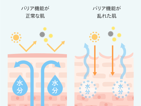 バリア機能が正常な肌 バリア機能が乱れた肌(比較図)